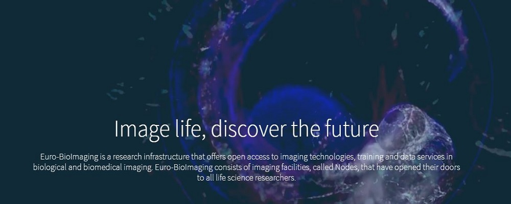 Al via Euro-Bioimaging, infrastruttura europea di ricerca per le tecnologie immaging per le ricerche biomediche e biologiche