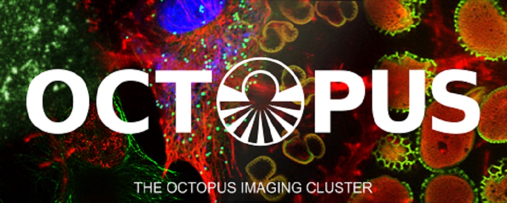 COVID-19: bando per accesso rapido alla struttura di imaging Octopus del Regno Unito